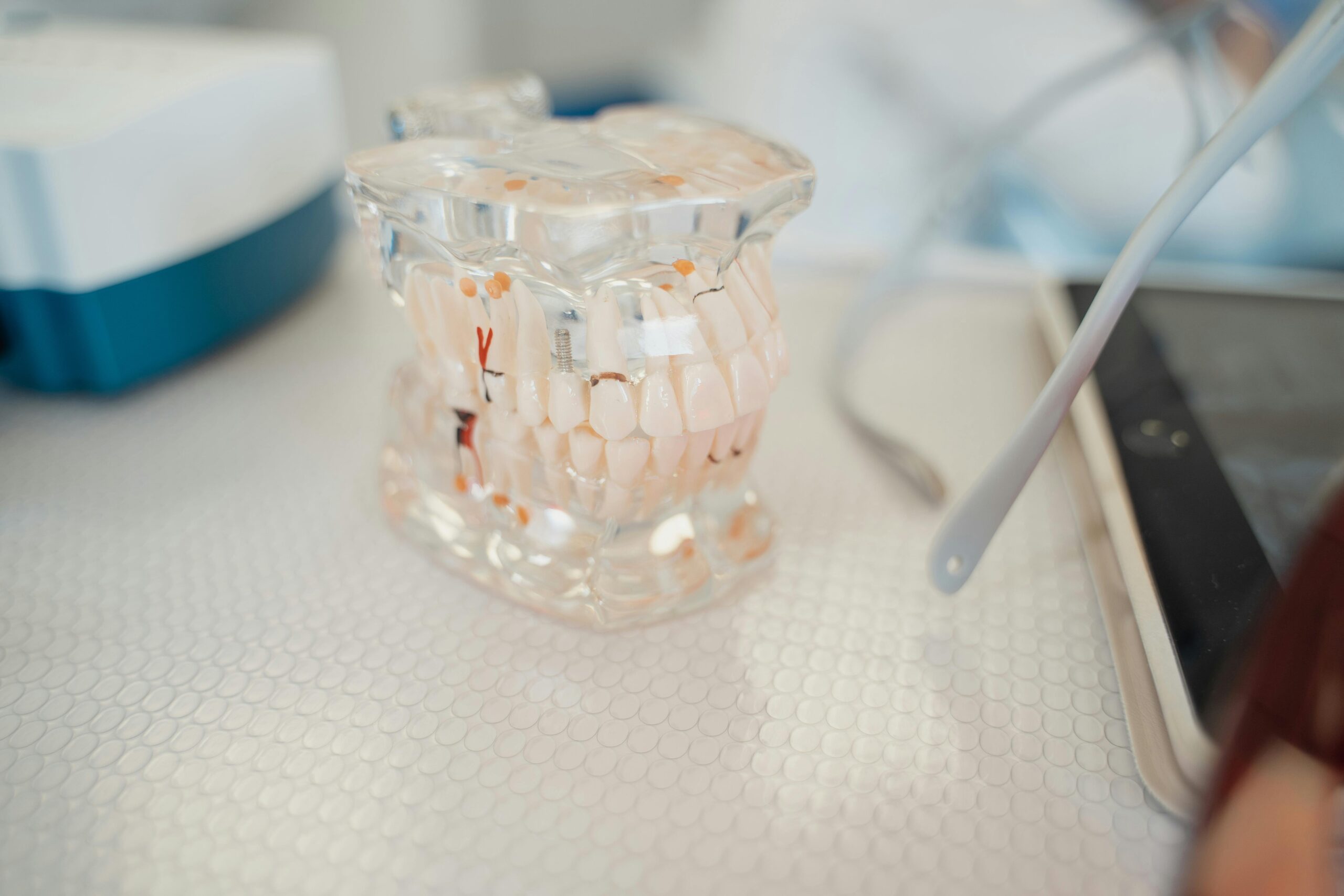 Wisdom Tooth Extraction at Lebanon Park Dental