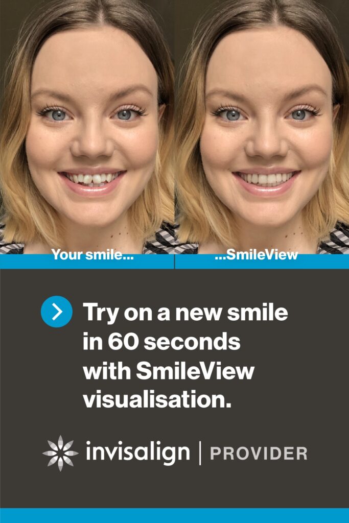 nvisalign SmileView before and after smile transformation at Lebanon Park Dental Group Twickenham