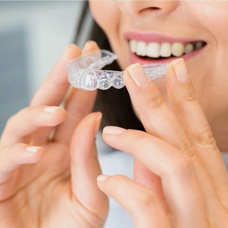 Invisalign Braces at Lebanon Park Dental Group