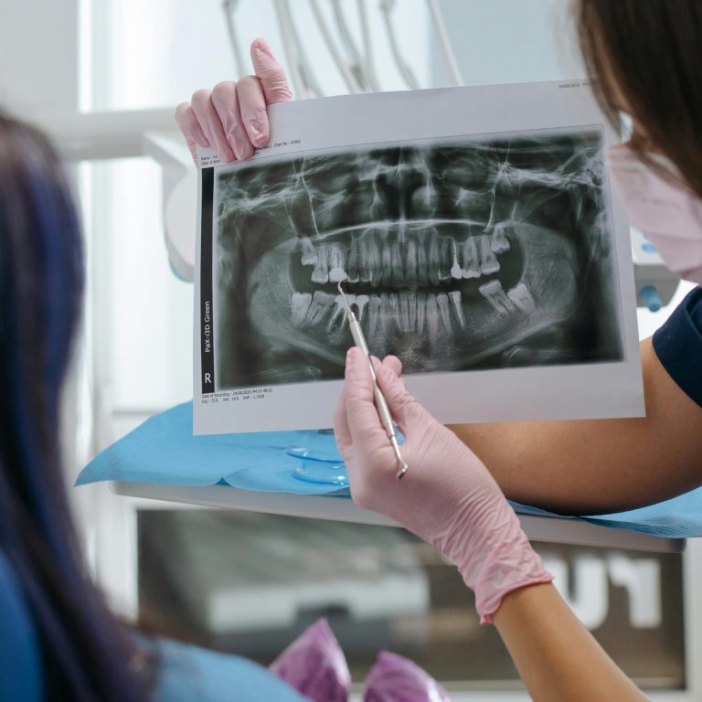 Radiographs at Lebanon Park Dental Group