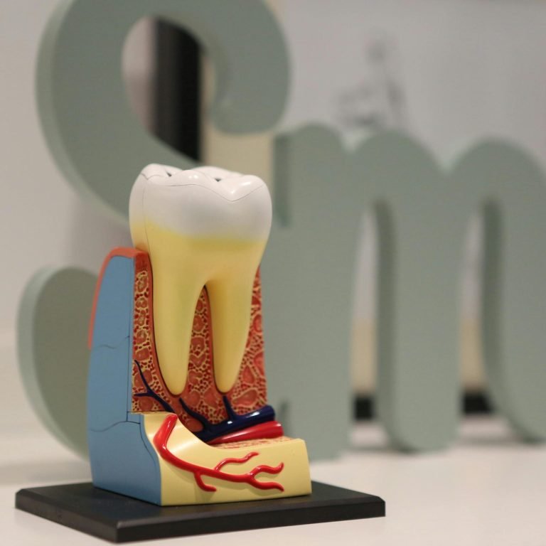 Root Canal at Lebanon Park Dental Group