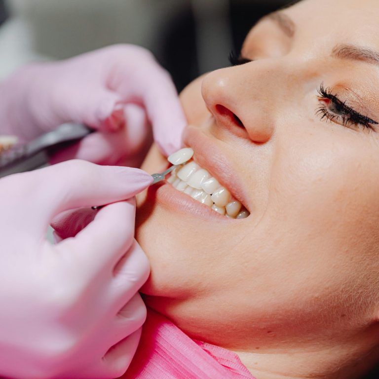 Teeth Whitening at Lebanon Park Dental Group